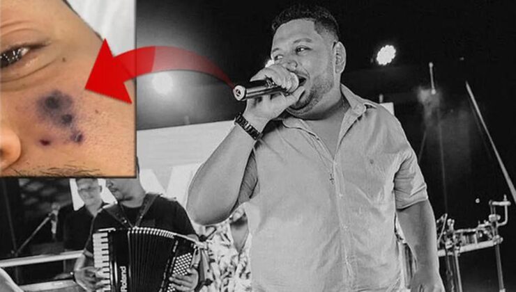 Hayranları ve sevenleri şoke oldu! Örümcek ısırığı müzikçi Darlyn Morais’in sonu oldu