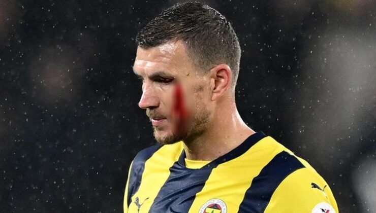 Maç sonu pişman oldu, Dzeko’dan özür diledi